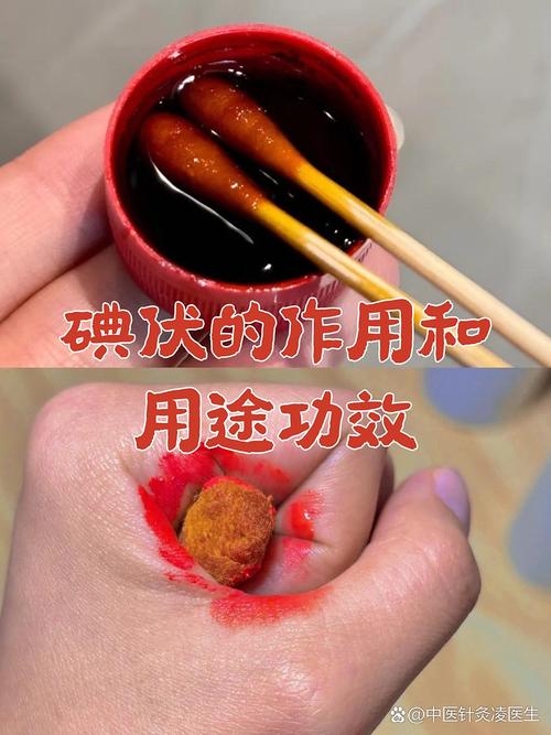 碘伏是一种含有碘的消毒剂,很多人家中常备
